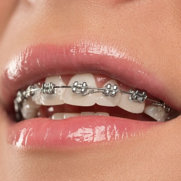 ortodonzia smile center dentista verona