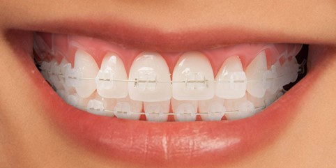 ortodonzia dentista verona