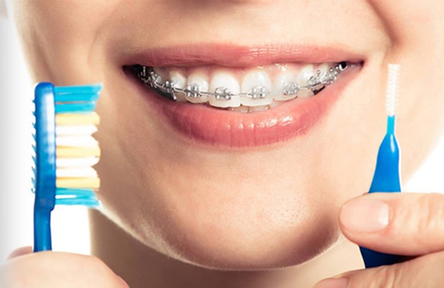 prevenzione dentale dentista verona